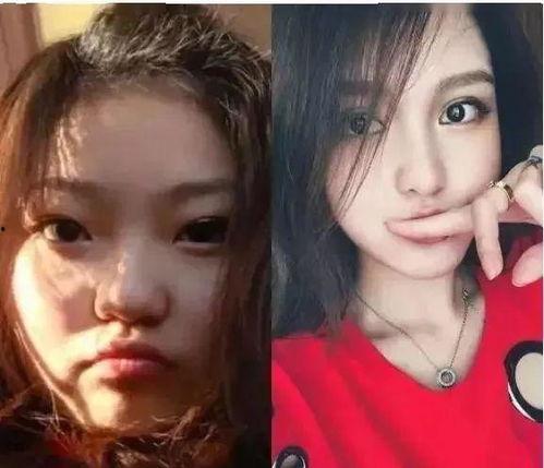 整容爆料视频,视频爆料揭露美丽背后的代价 第2张 整容爆料视频,视频爆料揭露美丽背后的代价 第2张